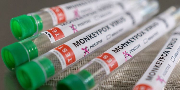 Anvisa recebe pedido de registro para teste de varíola dos macacos