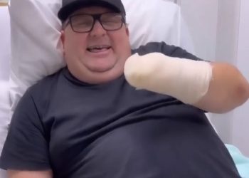 Humorista Pilha fala pela primeira vez sobre acidente com foguete e mão amputada