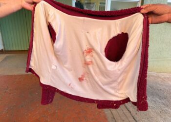 Conflito indígena: mulher de 32 anos é baleada na reserva do Ventarra, em Erebango