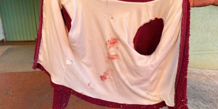 Conflito indígena: mulher de 32 anos é baleada na reserva do Ventarra, em Erebango