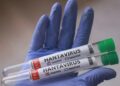 Morte por hantavirus é registrada em Paulo Bento