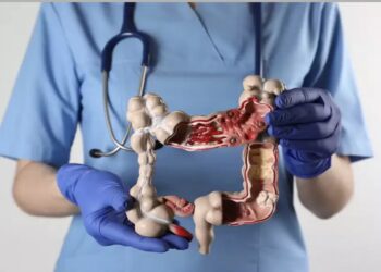 Doenças inflamatórias intestinais crescem mais de cinco vezes no Brasil em 13 anos